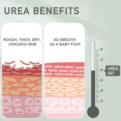 Mouriven Urea 40% para pies, hidrata y suaviza