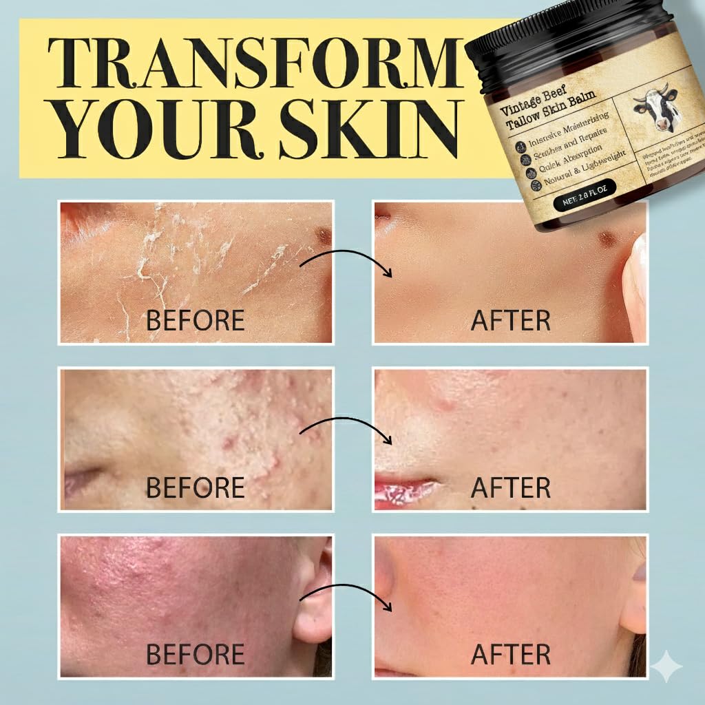 Applying MTGBO Beef Tallow Honey Balm on the face for quick absorption