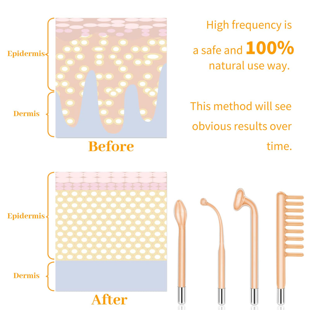 MYSWEETY High Frequency travel case demonstrates compact, travel-ready skincare kit