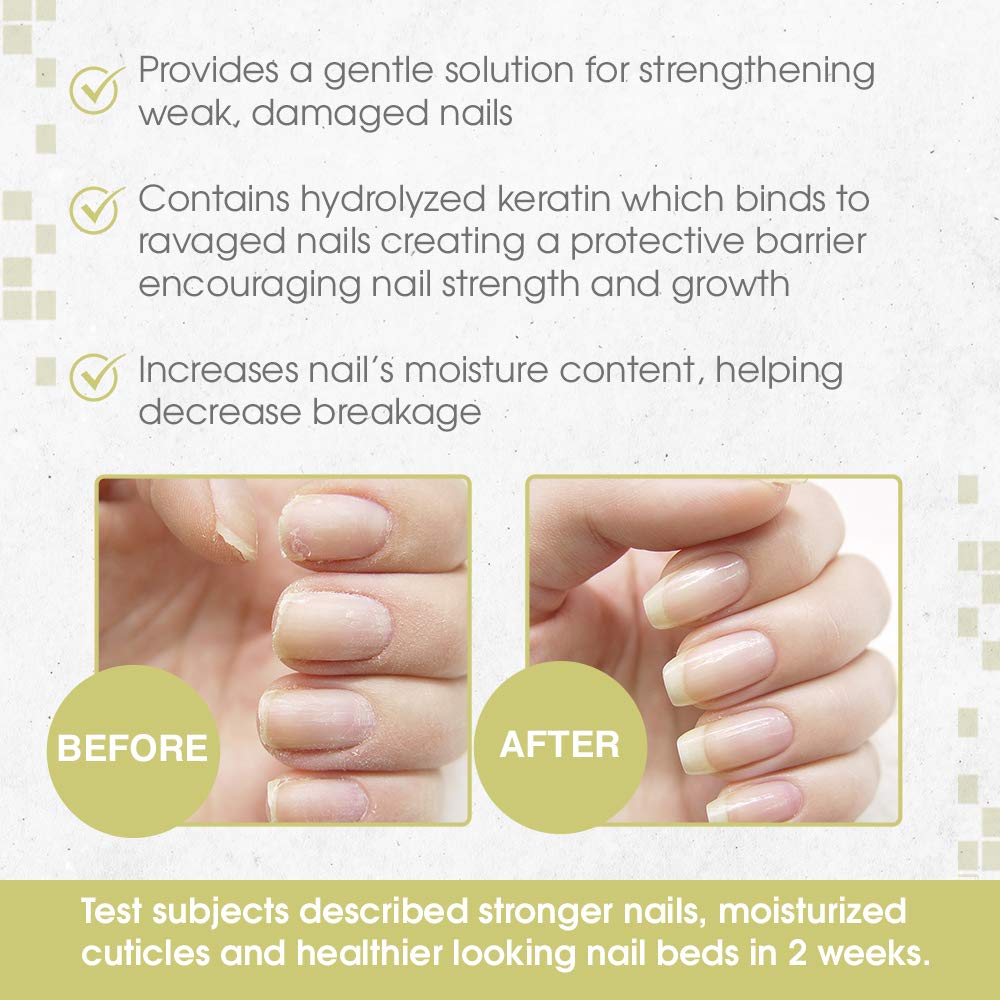 Nail Tek Nutritionist: barrera protectora ante factores ambientales.