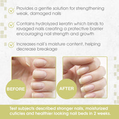 Nail Tek Nutritionist: barrera protectora ante factores ambientales.