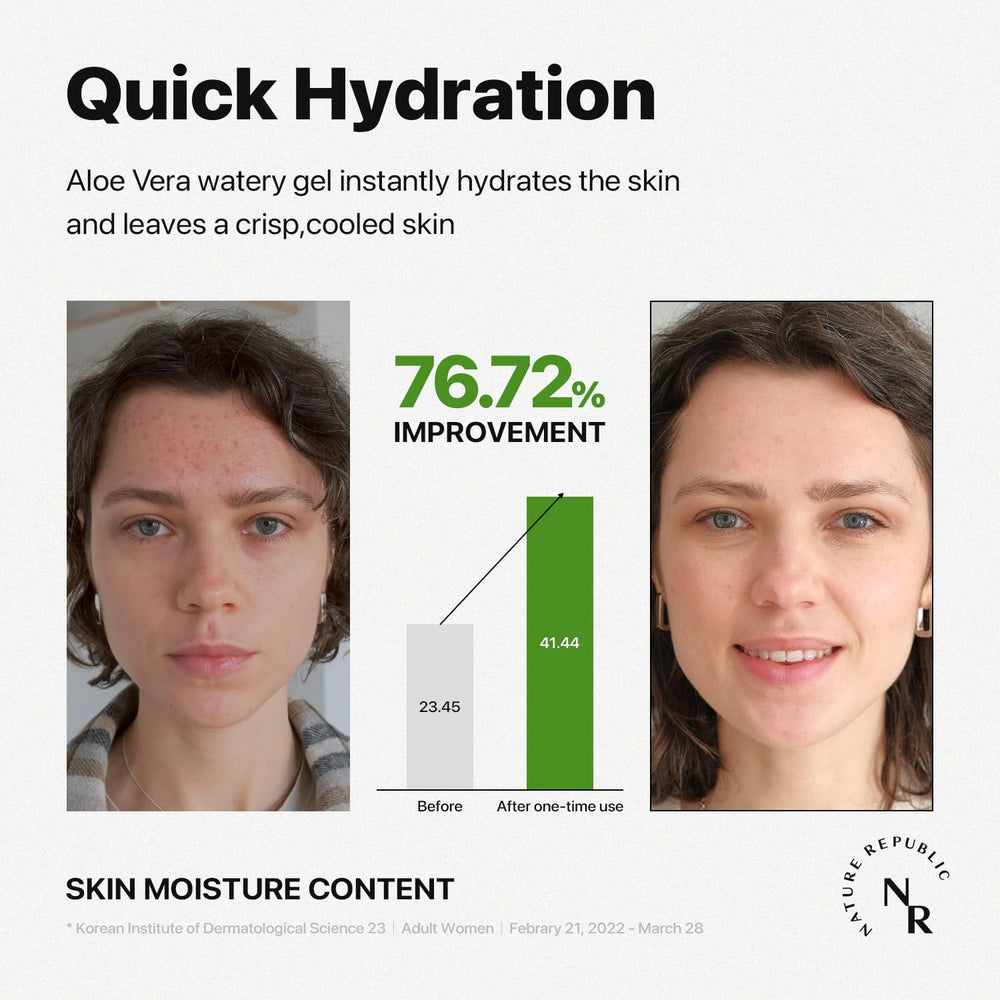 Nature Republic Aloe Vera gel after sun relief with cooling hydration