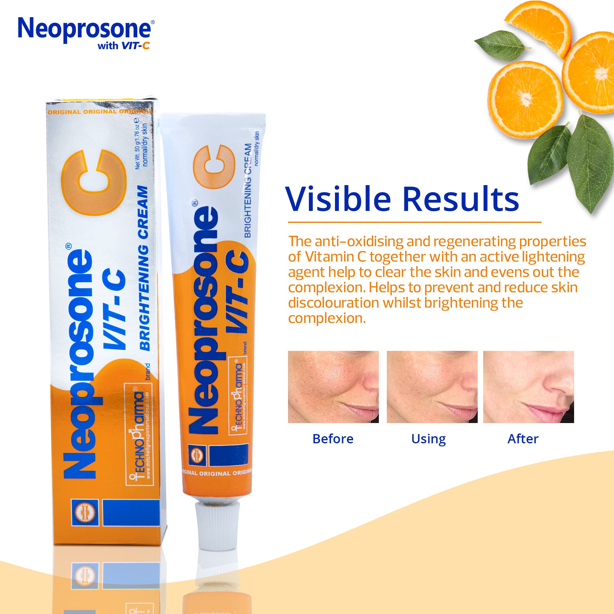 Arbutina natural en Neoprosone para un brillo suave y uniforme.