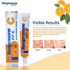 Arbutina natural en Neoprosone para un brillo suave y uniforme.