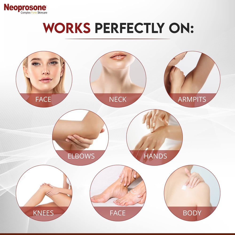 Neoprosone crema-mancha-zonas-privadas: tratamiento suave para áreas delicadas.