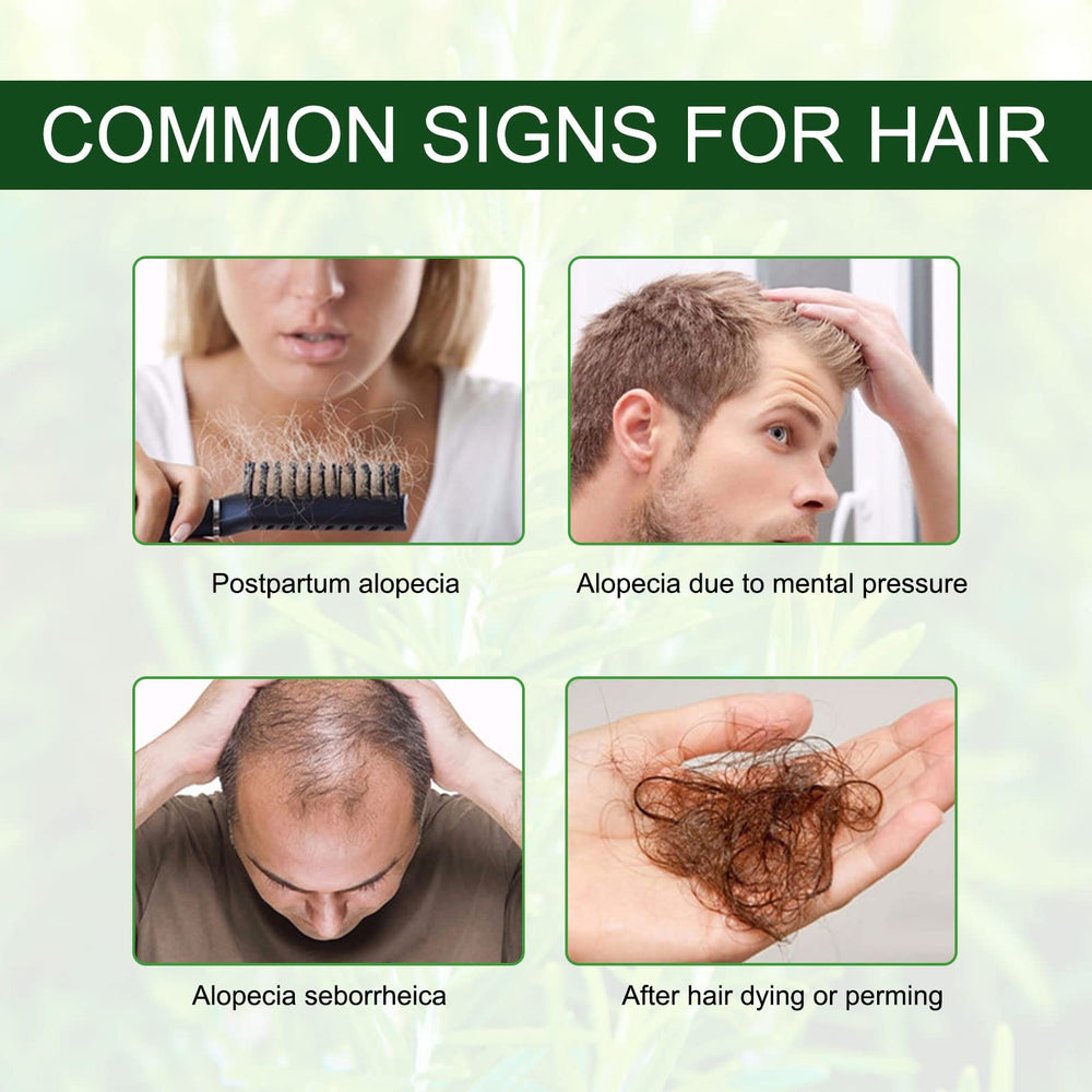 Masaje con aceite de romero NIFEISHI para cabello y cuero cabelludo.
