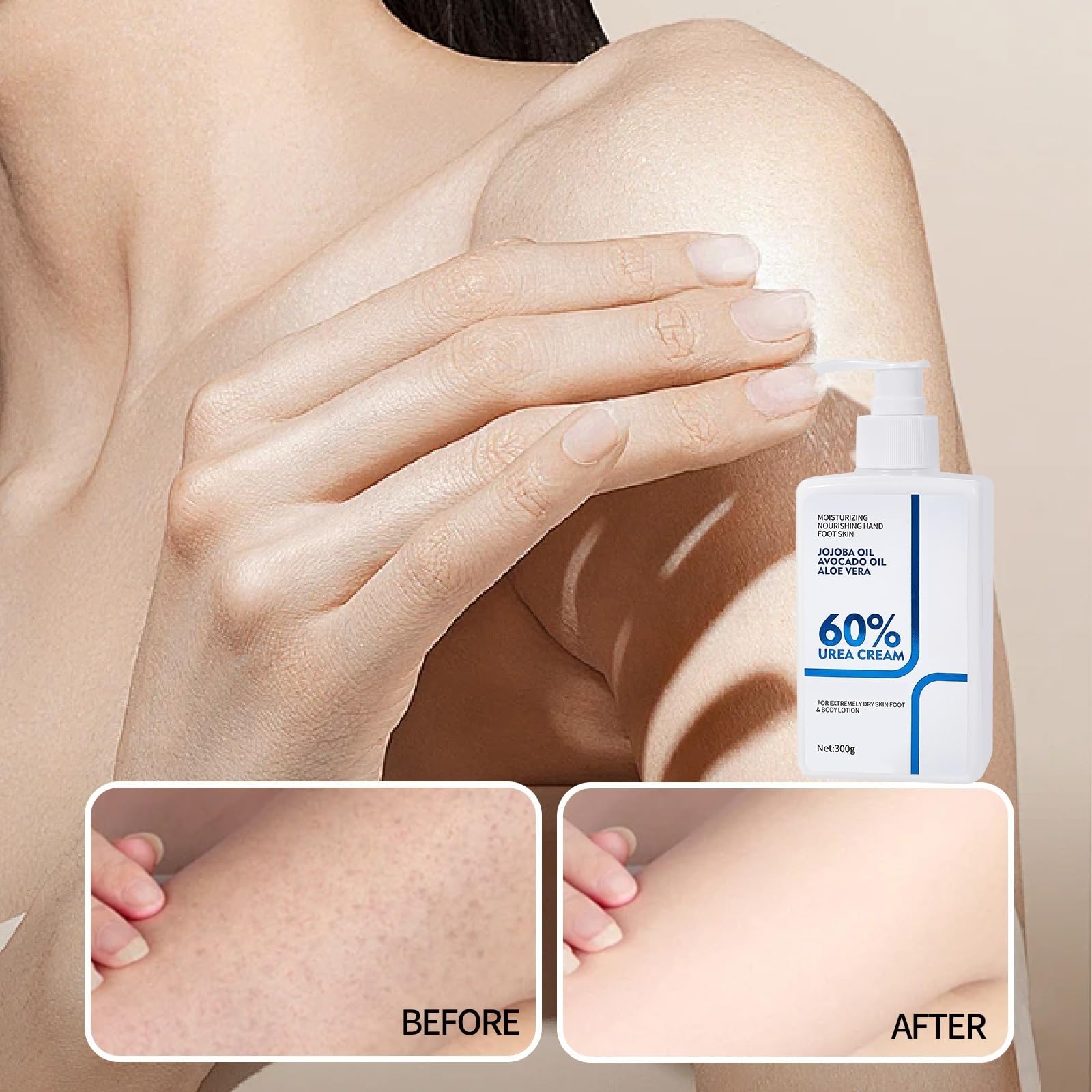 NIZENTA regalo de crema de urea 60% para cuidado personal.