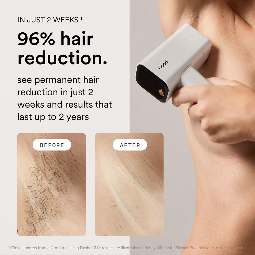 Nood Flasher Pro lente Ageless para mejora de la piel.