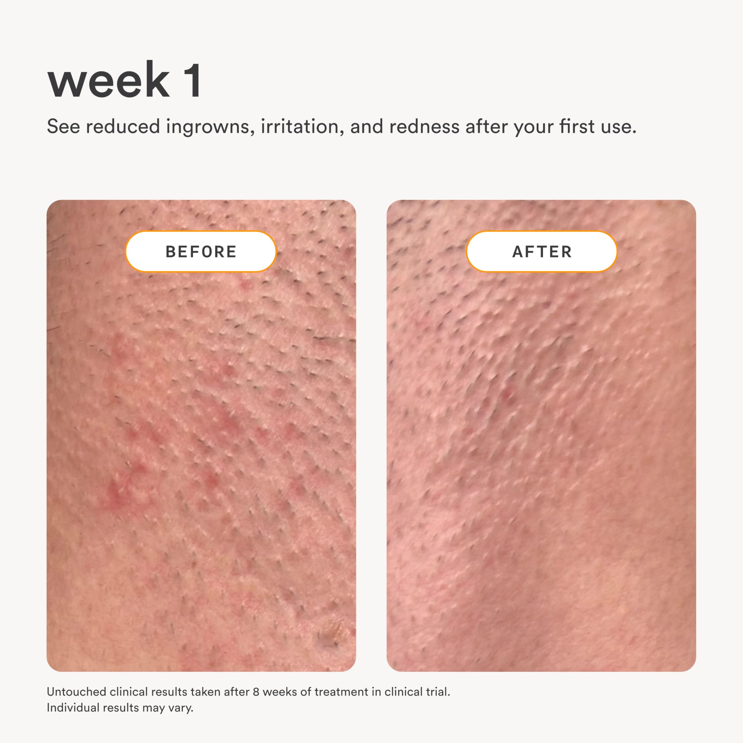 Nood Serum : convient à toutes les zones, peau sensible
