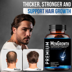 NutraPro MenGrowth: vitaminas para el cabello de hombres fortalecen desde dentro.