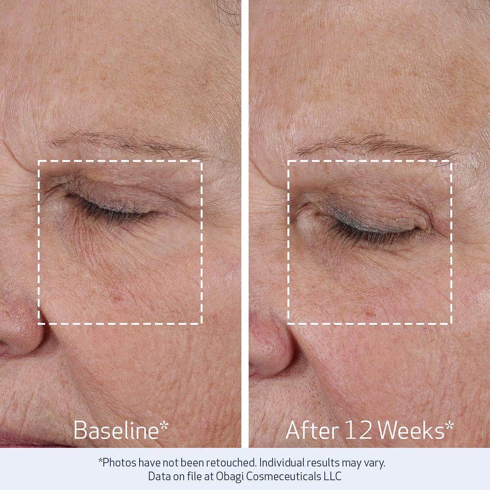 Obagi ELASTIderm texture closeup reveals rich, hydrating cream.
