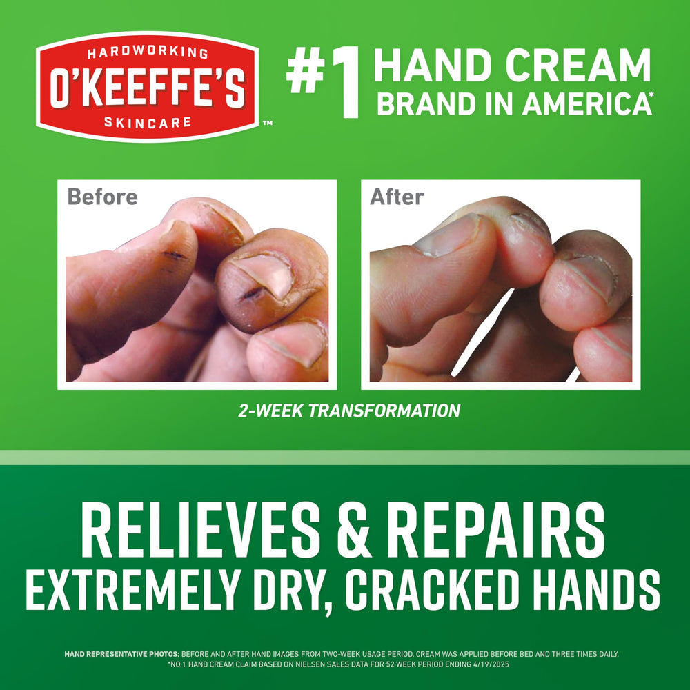 Aplicación de crema para hidratación rápida de manos secas.