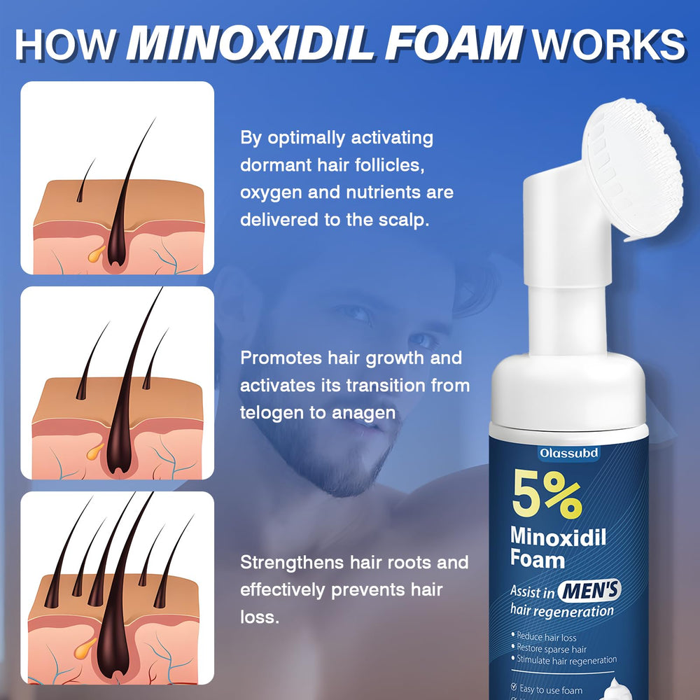 Cabello en progreso con Minoxidil Olassubd, posible mejora de densidad y vitalidad.