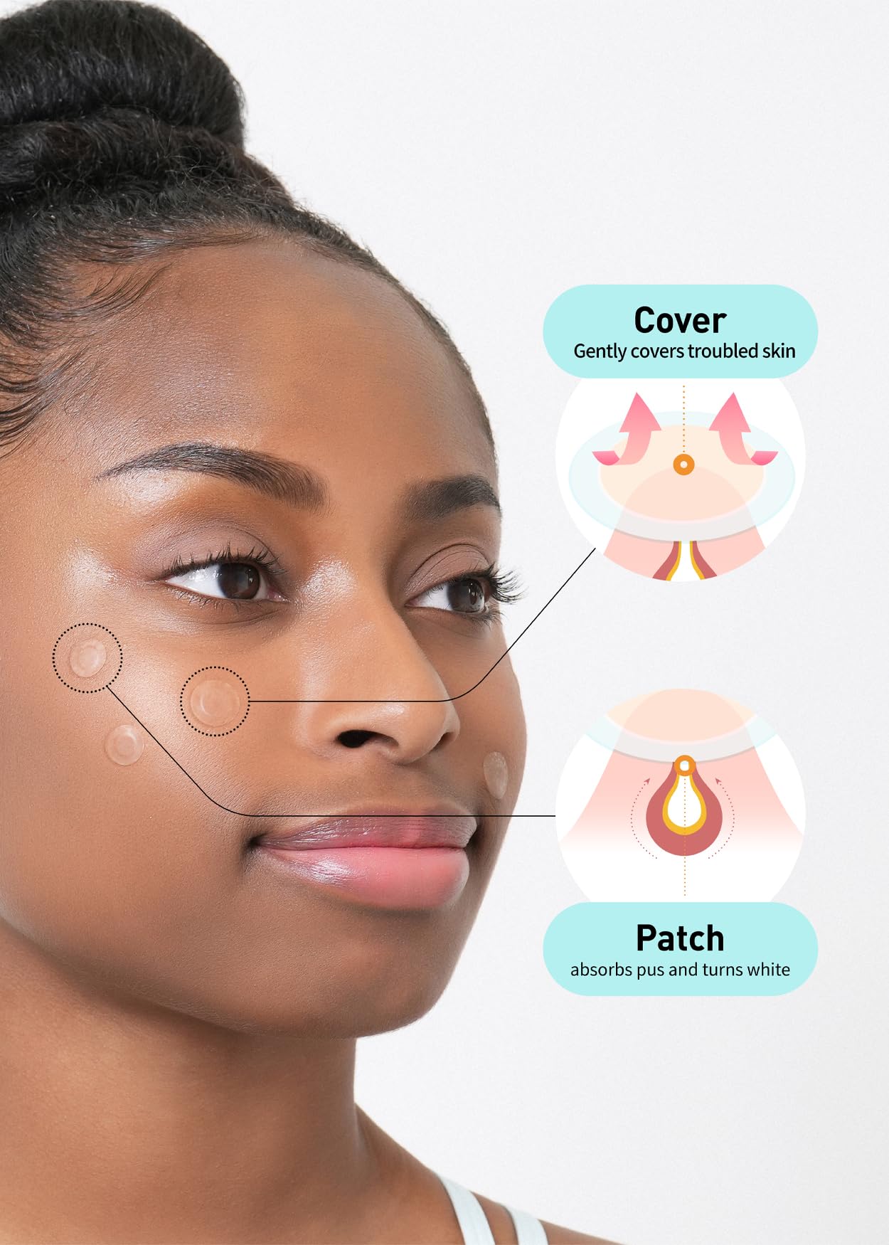 OLIVE YOUNG Care Plus Spot Patch cubre granitos para piel más limpia.