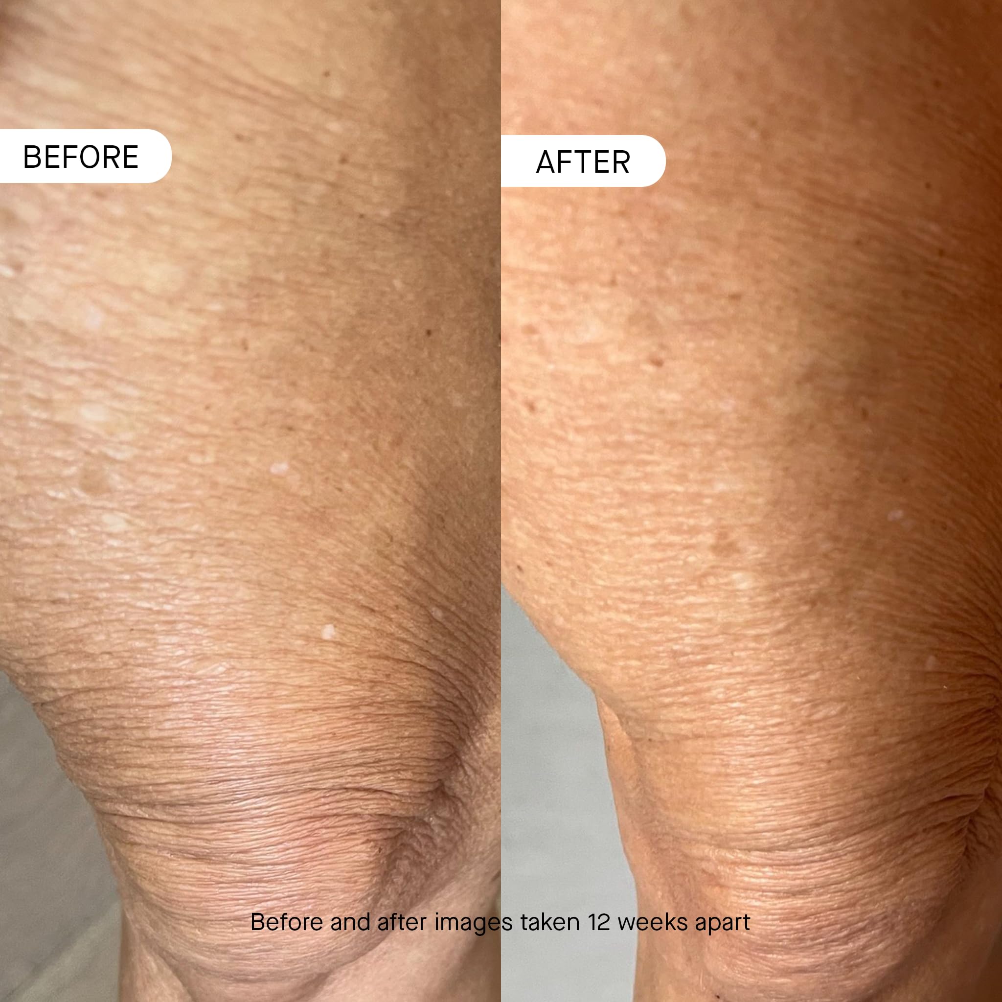 hidratación corporal rápida de oneskin BODY OS-01 calma la piel