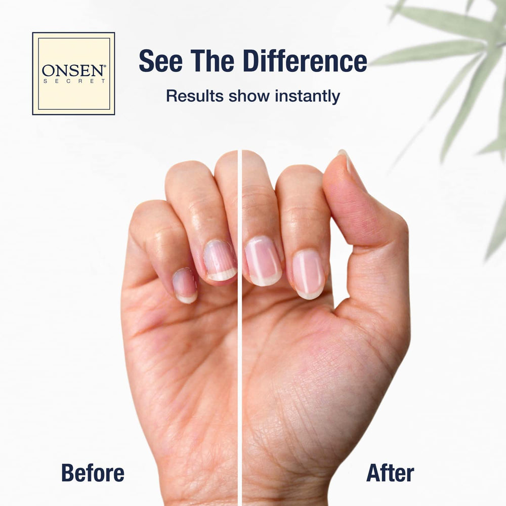 Kit de cuidado de uñas Onsen Secret para uso diario.