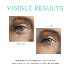 Aplicación precisa alrededor de los ojos con el serum #OOTD.