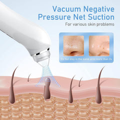 Ottleba extractor cabezas sustitucion seis para areas faciales distintas