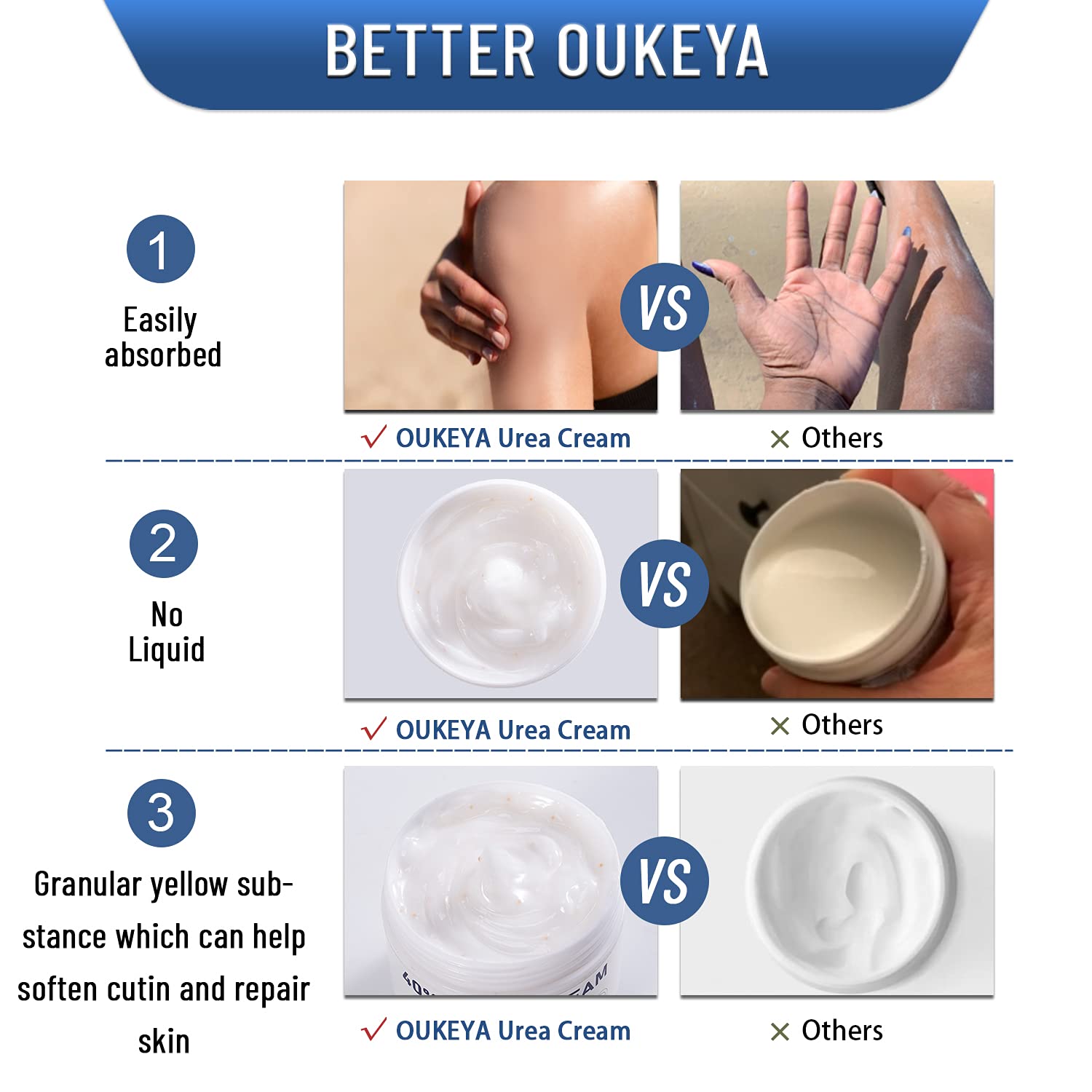 OUKEYA Urea Cream being applied to a dry heel