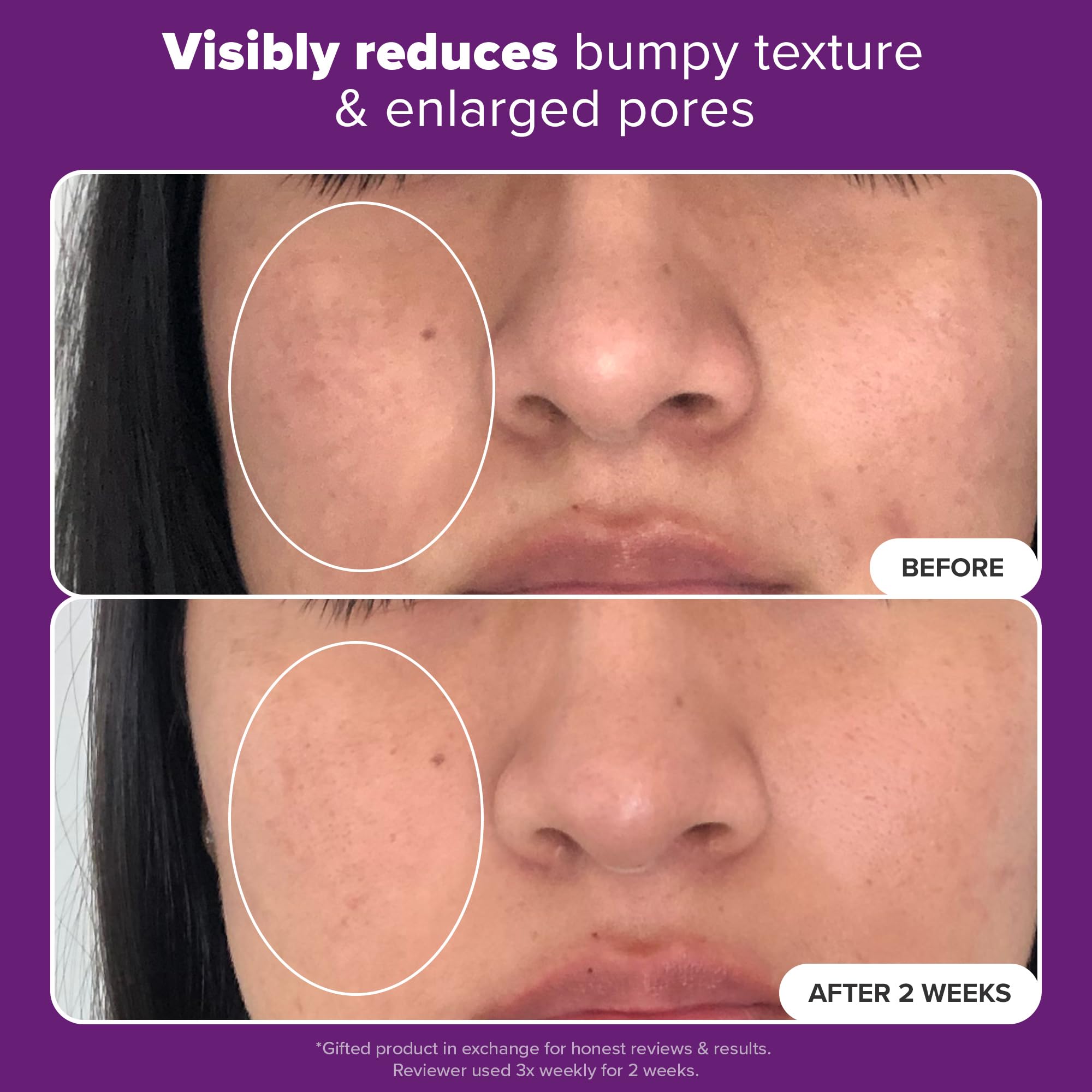 Paula's Choice Clinical 20% Niacinamida: aplicación manual para piel suave y luminosa.