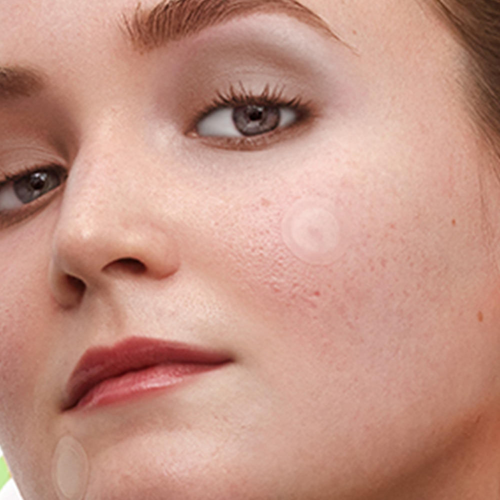 PEACE OUT Dots glow after use hints at a brighter, more even complexion.