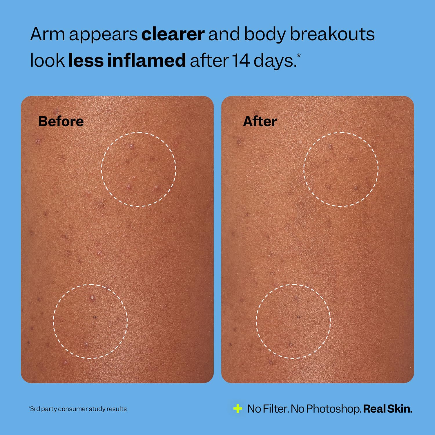 Peach Slices overnight-wear application demonstrates sleep-time patch use.
