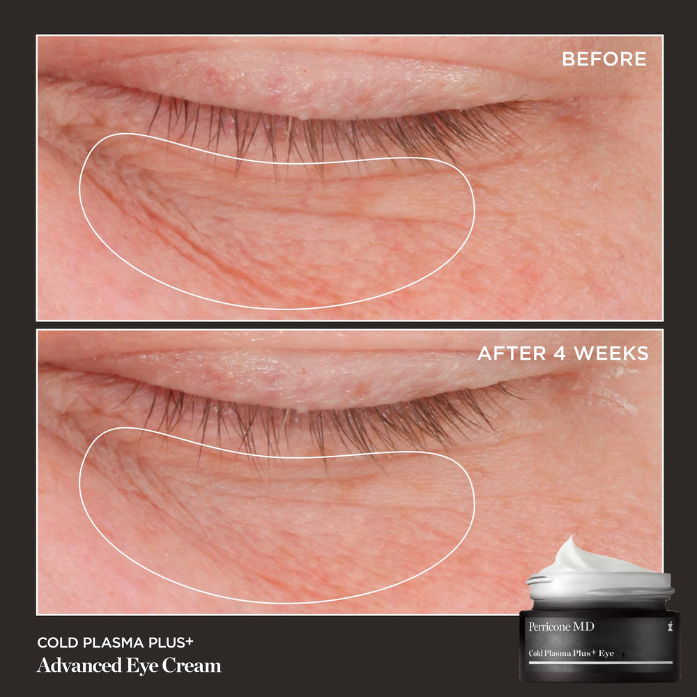 Perricone MD Plasma Frío Plus, ilumina el contorno de ojos para un aspecto más vivo.