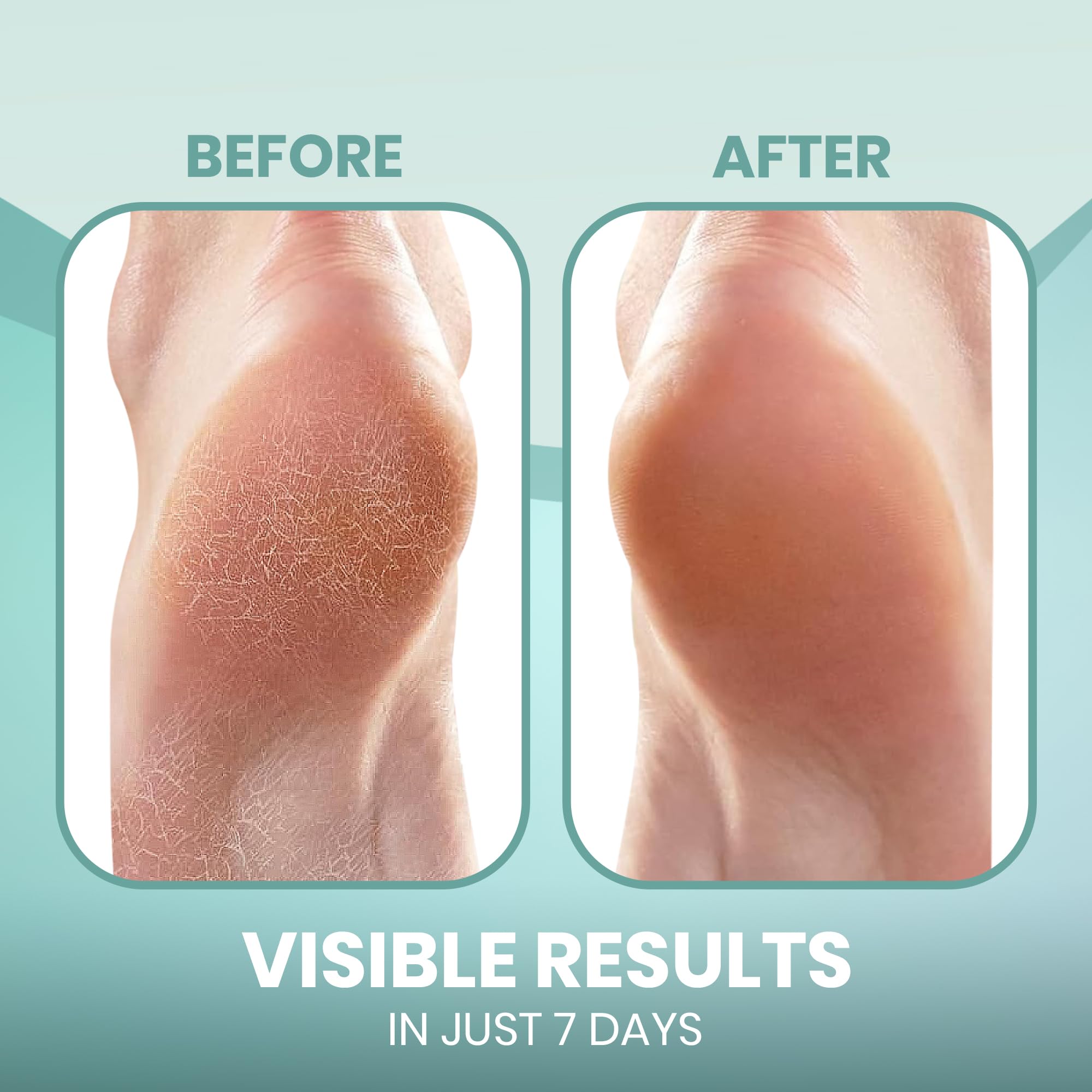 Forro de gel en calcetines PhysFlex para confort suave.