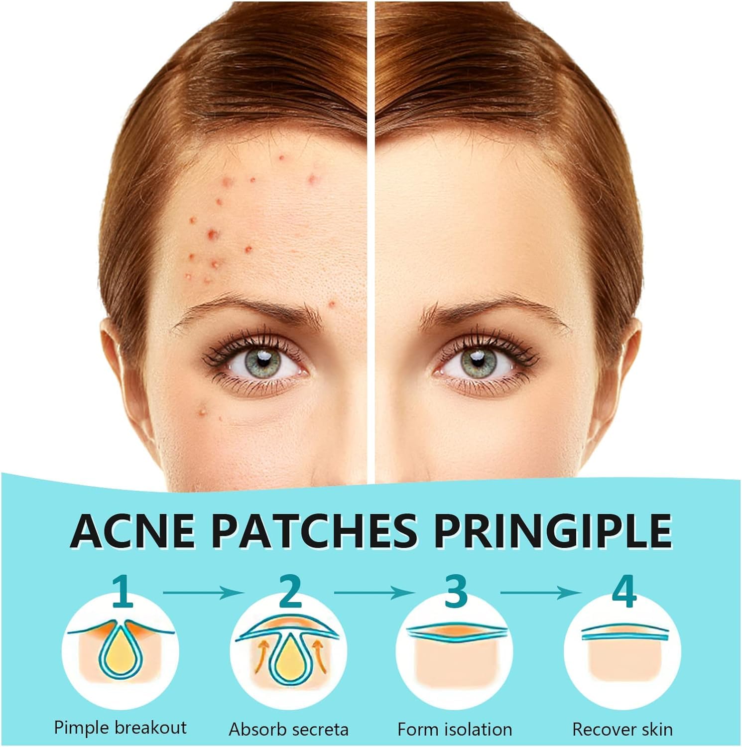 PICcircuit pimple patch 12mm covers larger spots for safe healing.