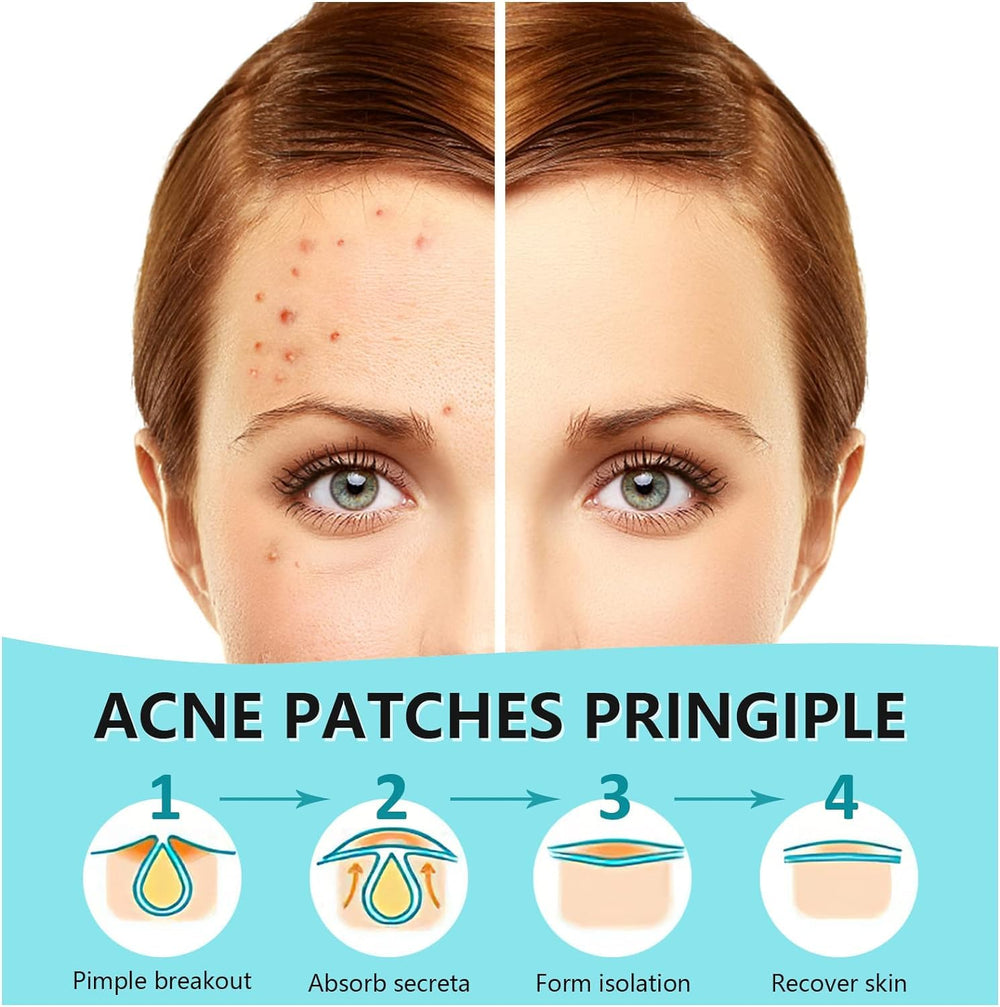PICcircuit pimple patch 12mm covers larger spots for safe healing.