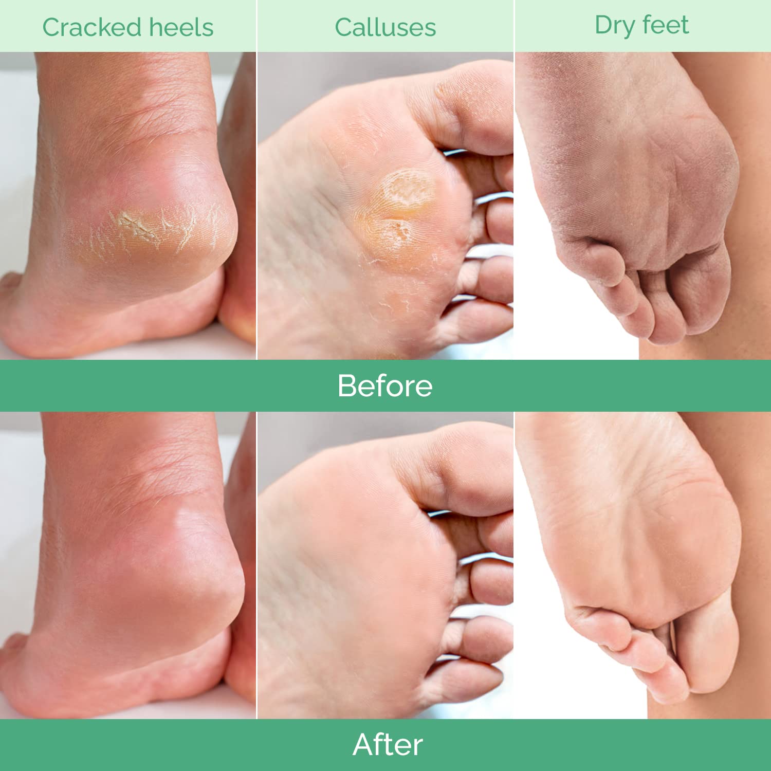 PLANTIFIQUE application masque pieds – étape rapide pour soin maison
