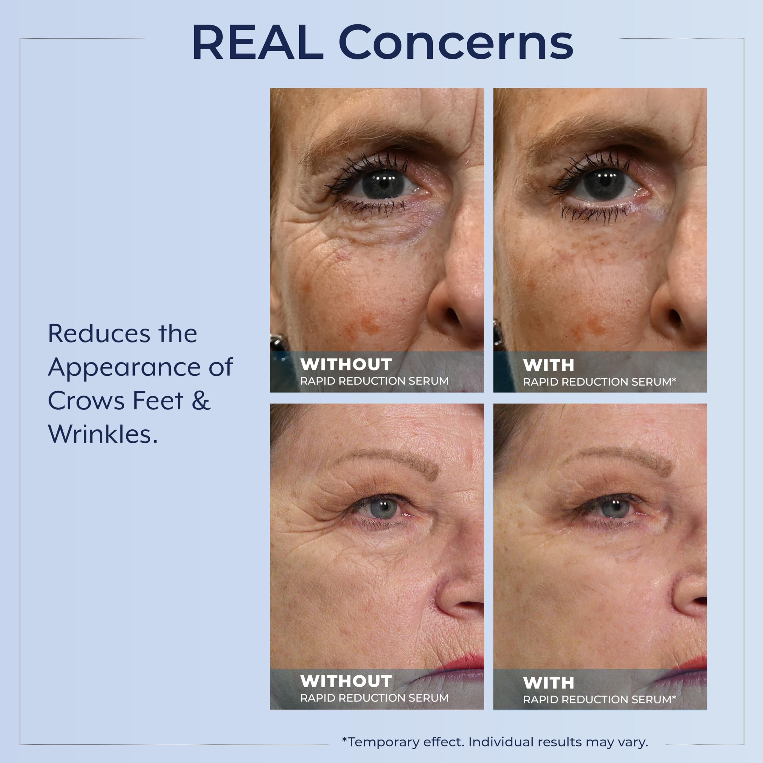 Aplicación clara de Plexaderm con acabado satinato para un look natural.