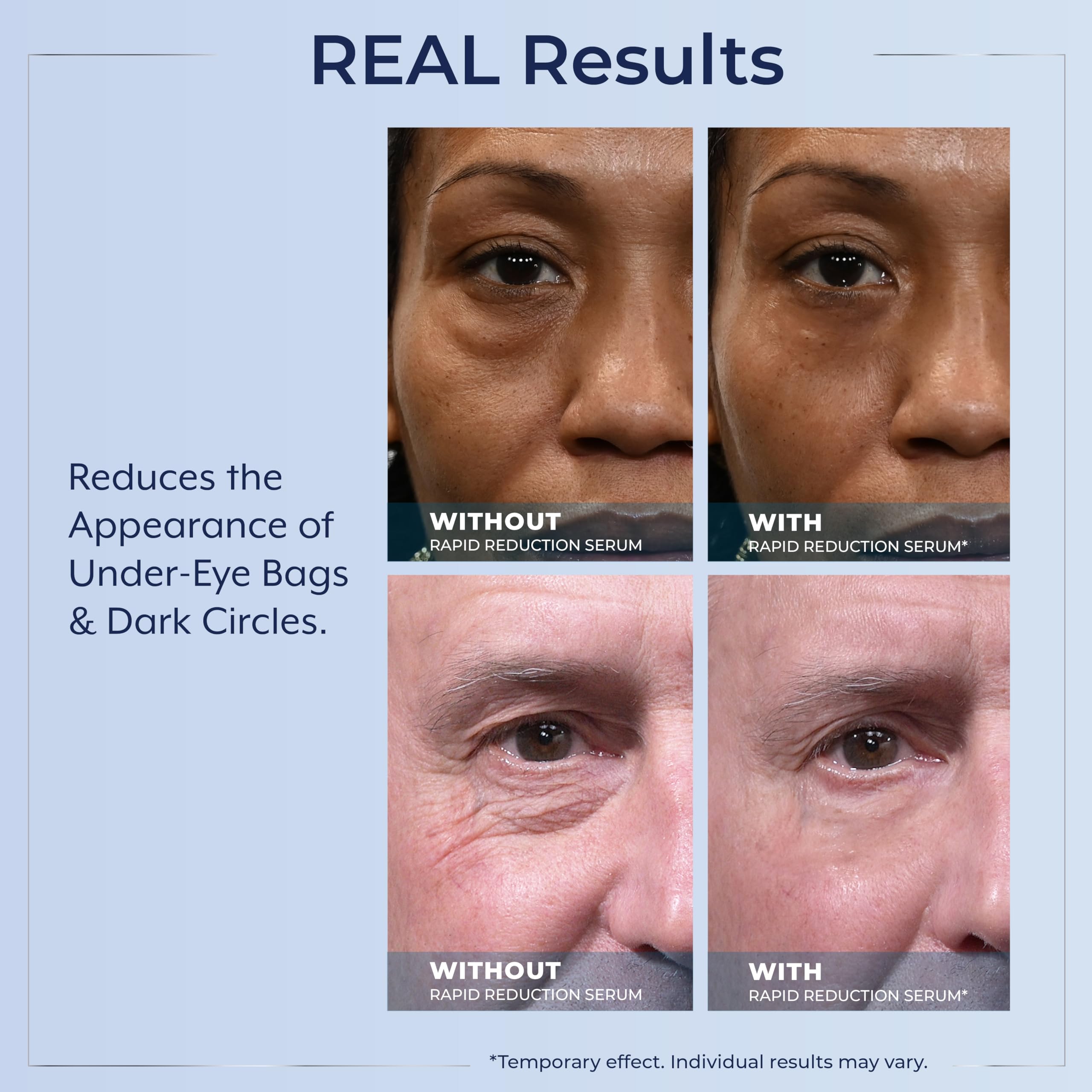 Plexaderm efecto lifting temporal que se seca para un look natural.