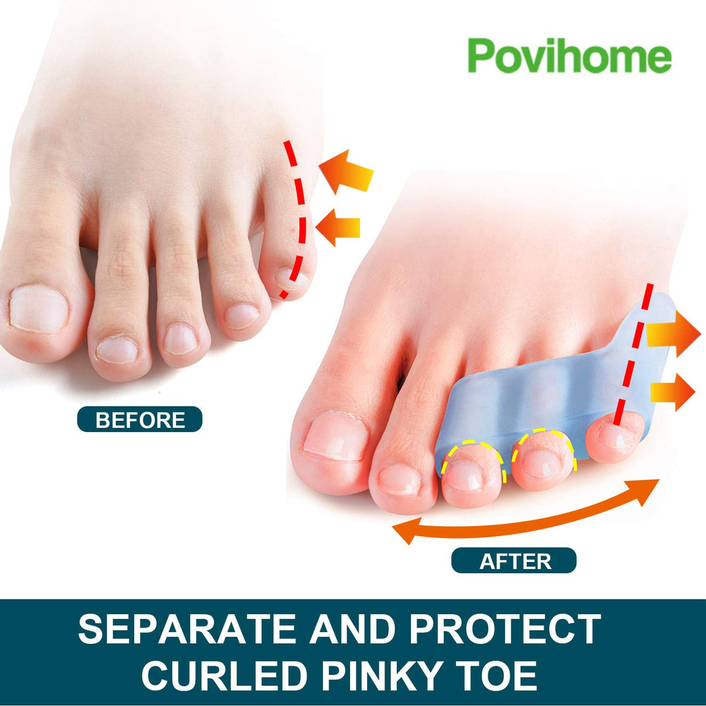 Povihome separadores dedo meñique de silicona suave para comodidad diaria.