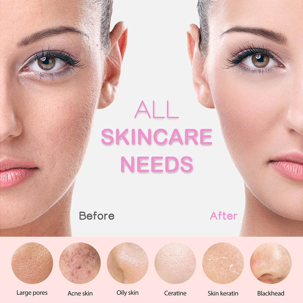 PRITECH modo masaje suave estimula circulación y relajación facial