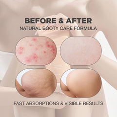 PROOT Exfoliante para glúteos, ingredientes naturales visibles cuidan la piel y reducen irritaciones