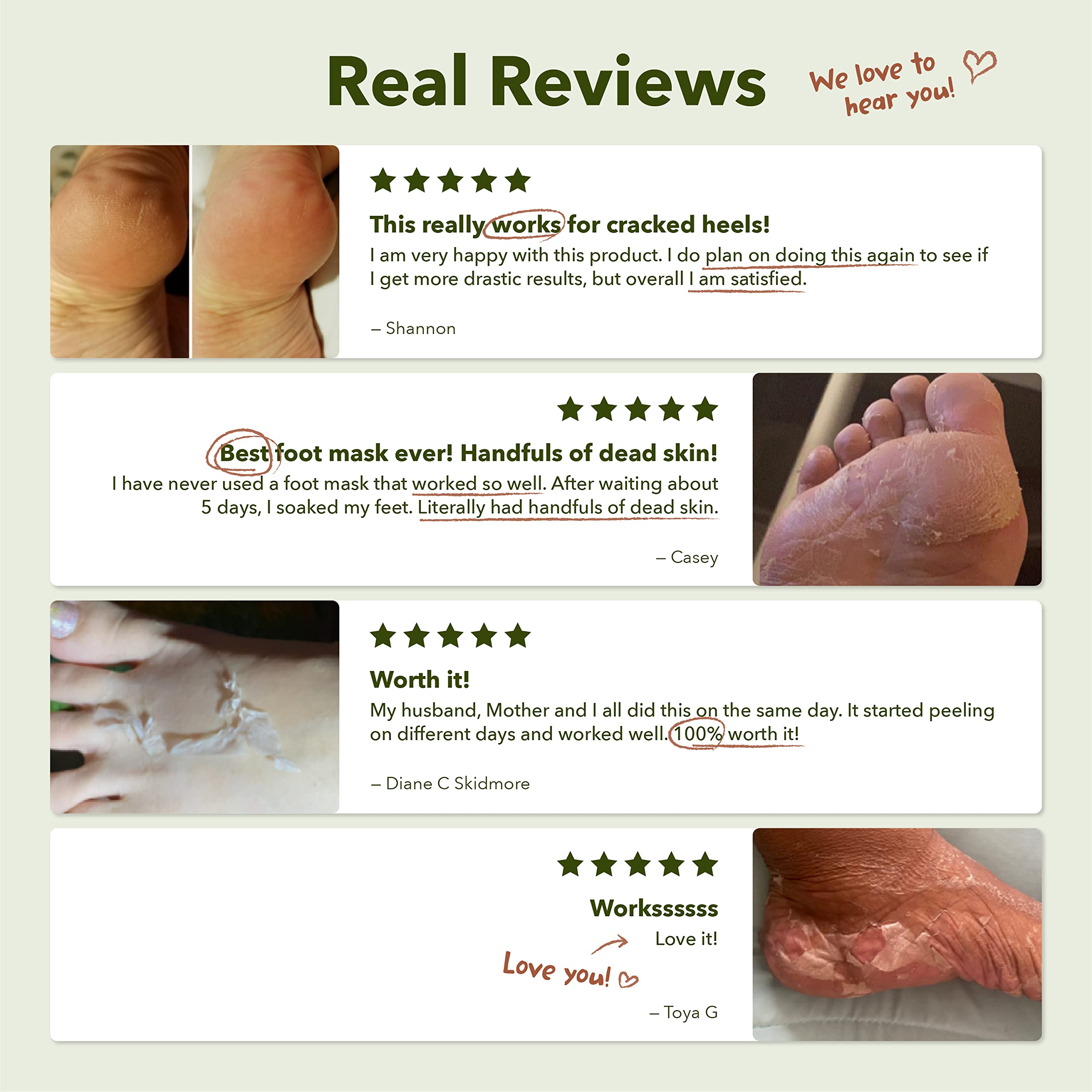 Purederm pie regalo ideal para autocuidado en casa.