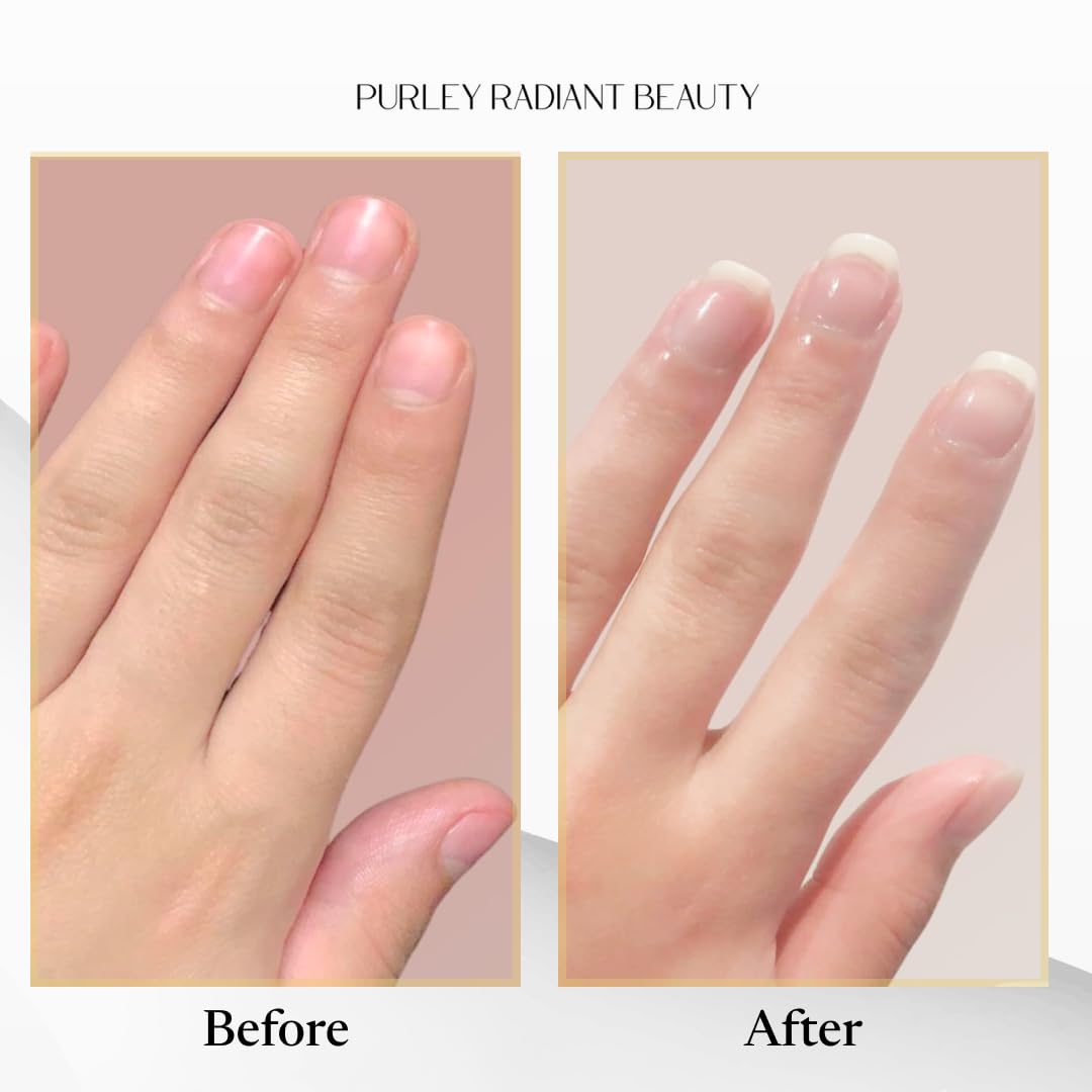 Apto para todo tipo de uñas, incluso tras recuperación de tratamientos.