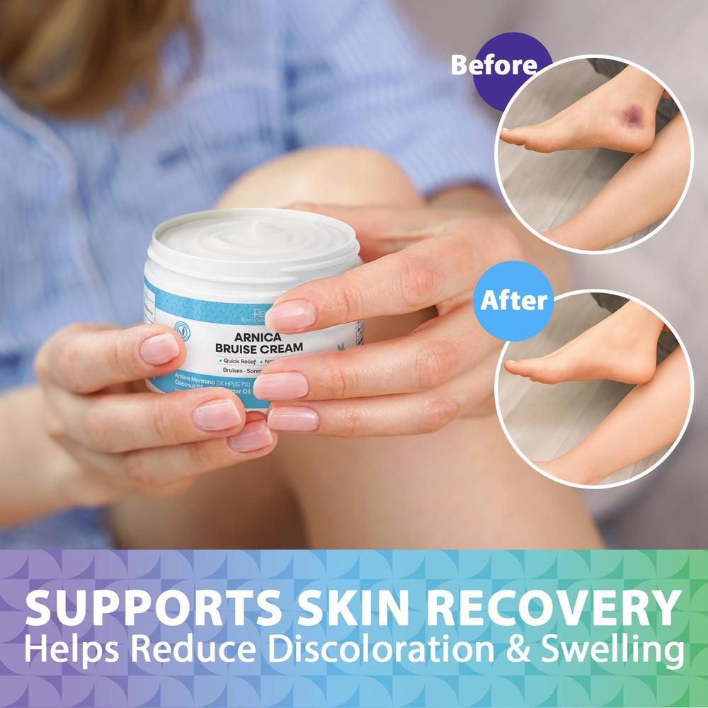 Recuren Plus Arnica crema, Vitamina K1 para tono suave de la piel.