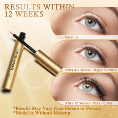 Péptidos y biotina en Recuren Plus Serum potencian el crecimiento visible.