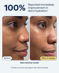 Remedy Science ceramidas cuádruples, piel suave y protegida durante el día.