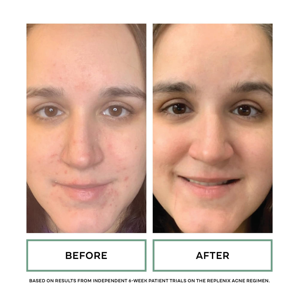 Replenix BP Acne Face Wash, ritual-diario recomendado para iniciar y finalizar el día.