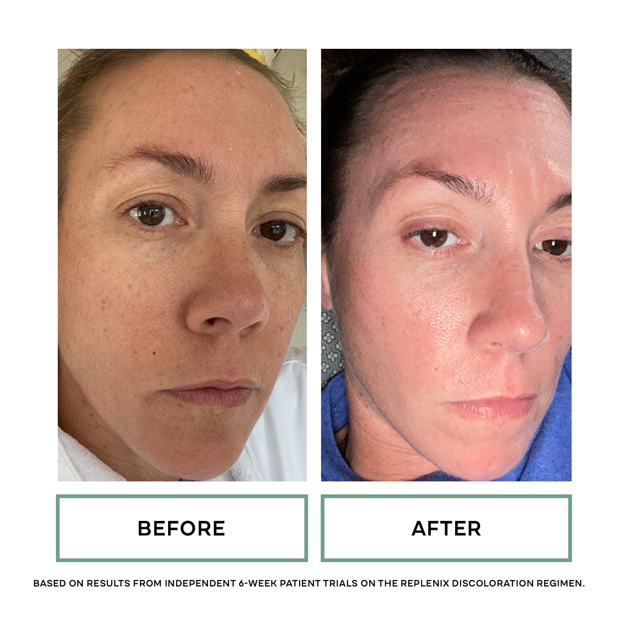 Replenix Glycolic 10% – caja 60ct – conveniencia para rutina constante.