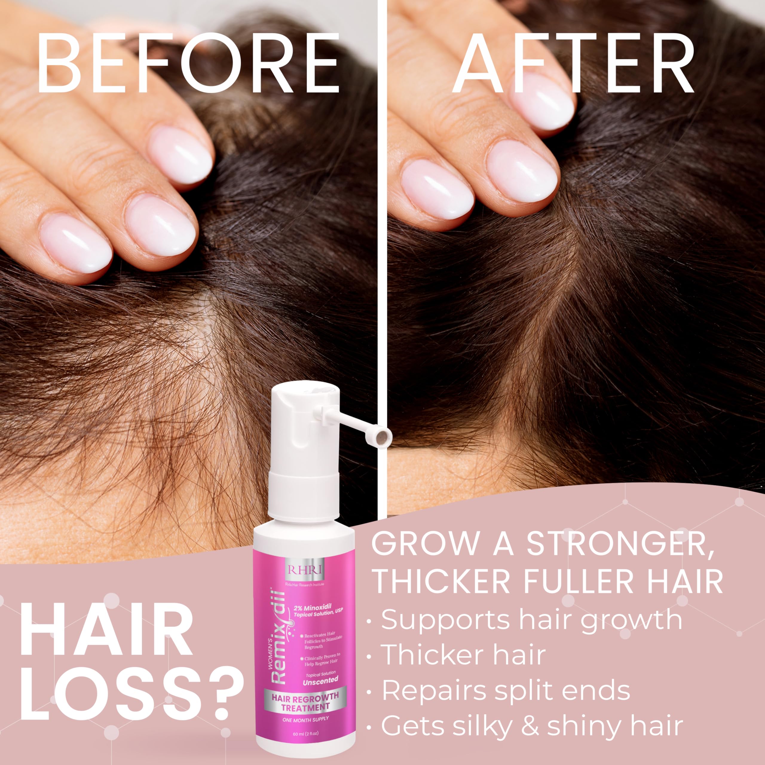 Rida Hair Minoxidil spray applied to scalp demonstrating simple daily regimen.