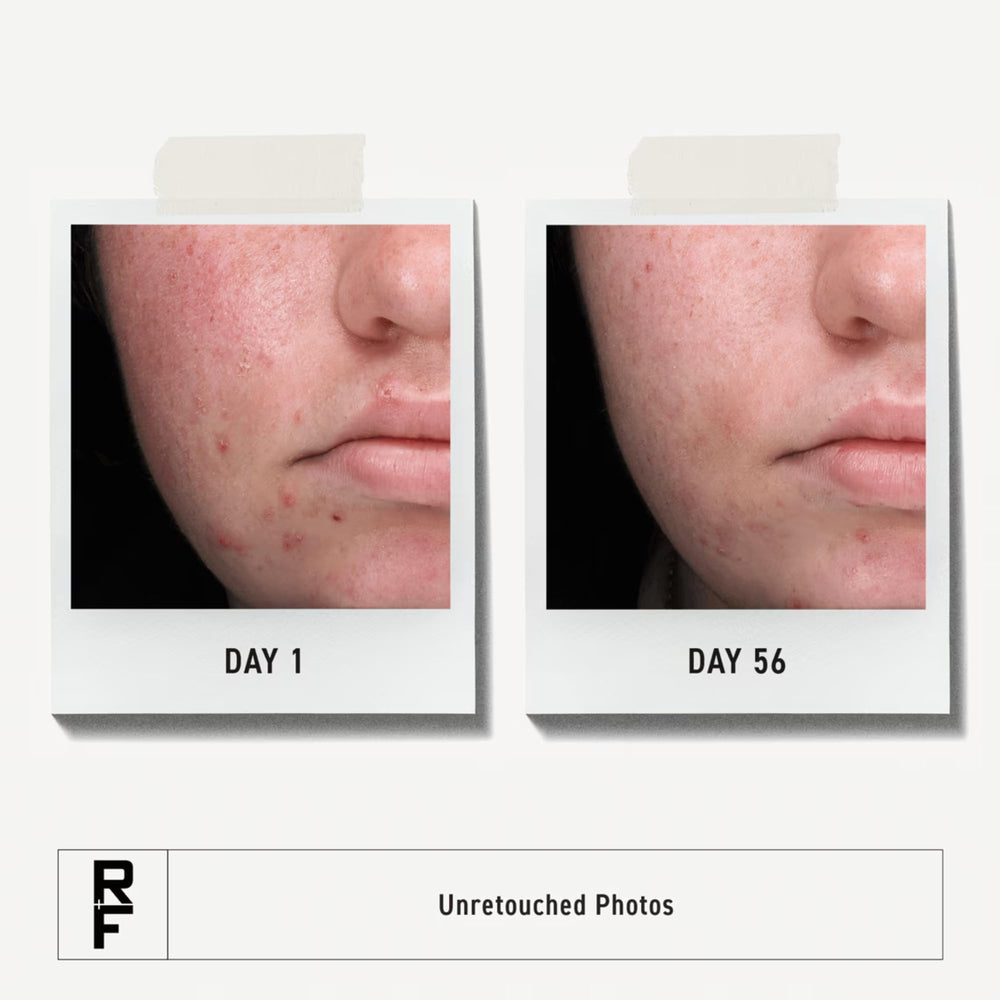 Rodan + Fields Spotless Regimen, lavado diario con textura cremosa para poros limpios