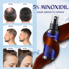 RootStim Minoxidil 5% con romero: frascos del paquete de 3 para uso continuo.