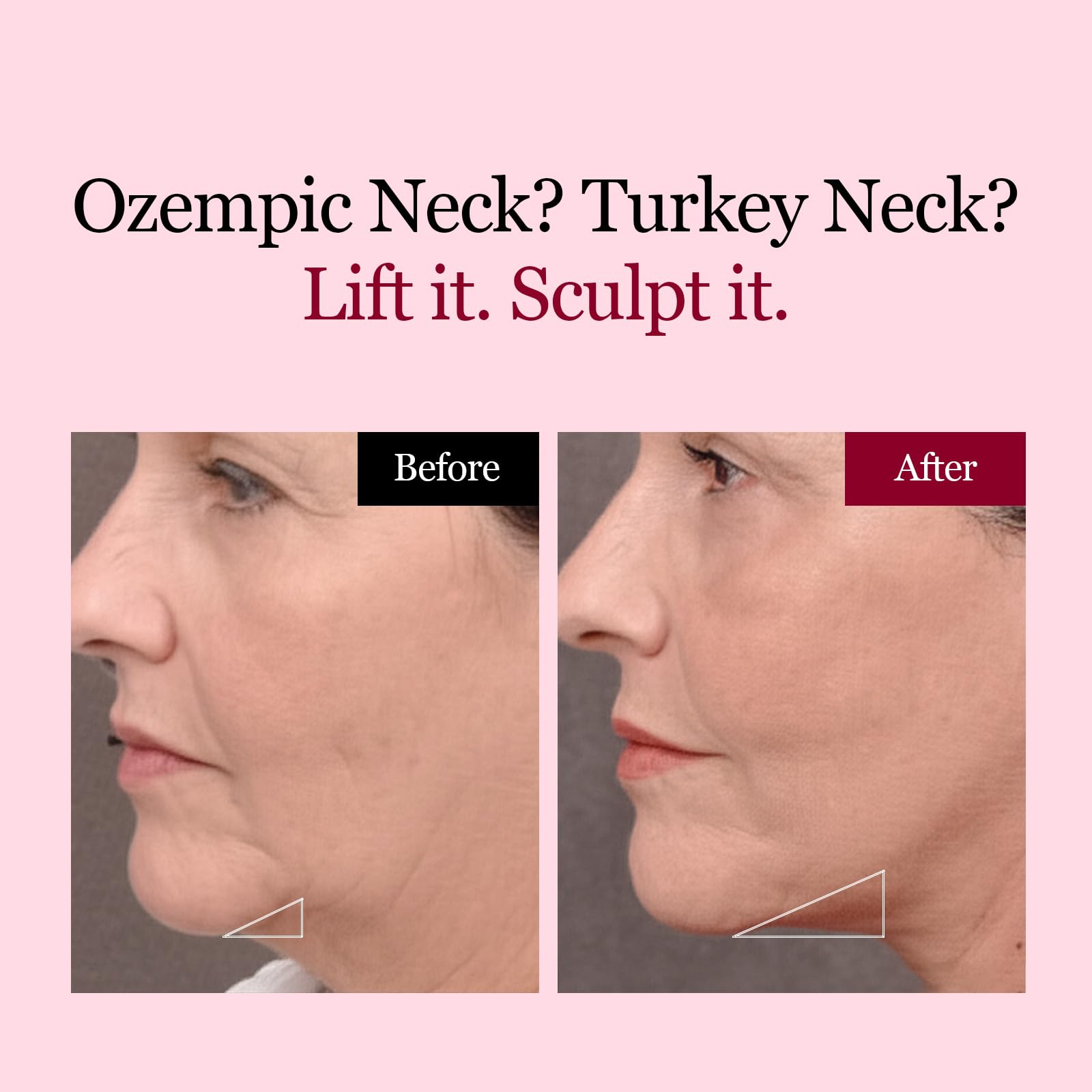 ROUND LAB Hidrogel para cuello con ajuste cómodo.
