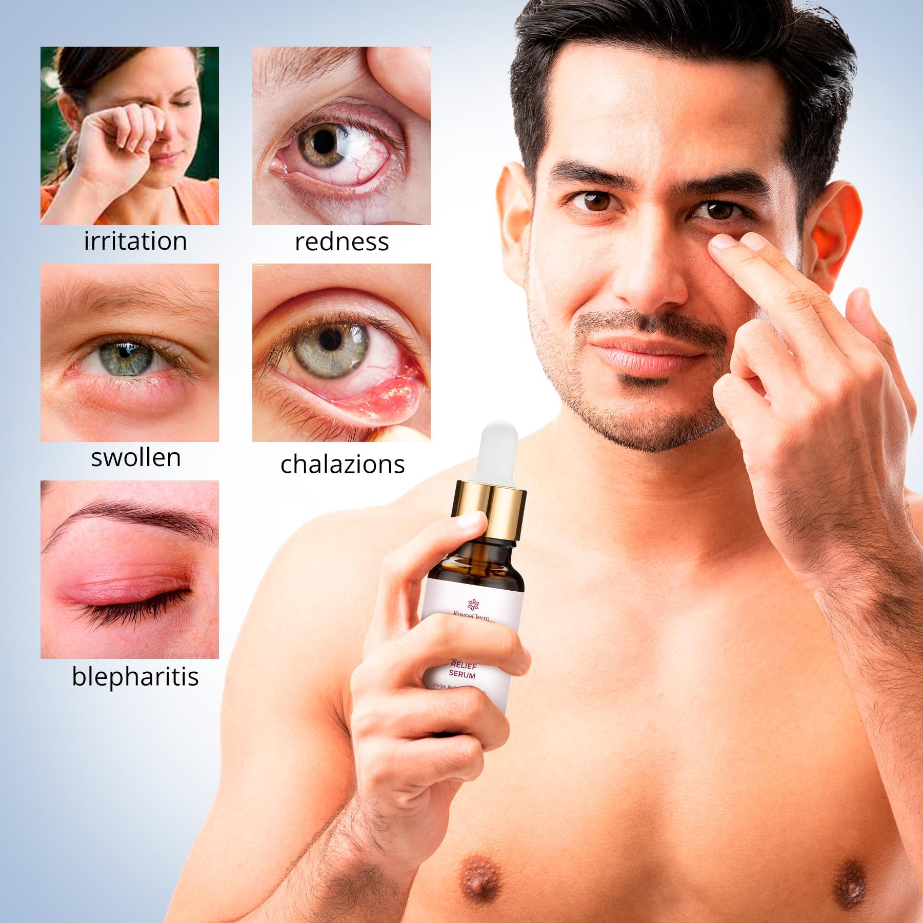 Roycederm: suero ocular, cuidado del párpado para uso diario.