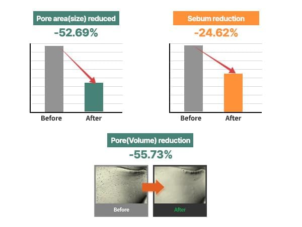 Piel sensible soporta S.NATURE AQUA SQUALANE crema sin irritación