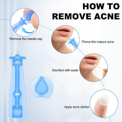 Sarini set cuidado acne ultra fino: manejo higiénico en casa.